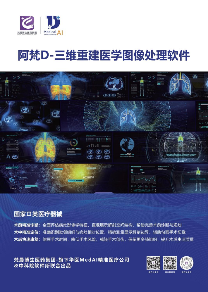 阿梵D-招商版
